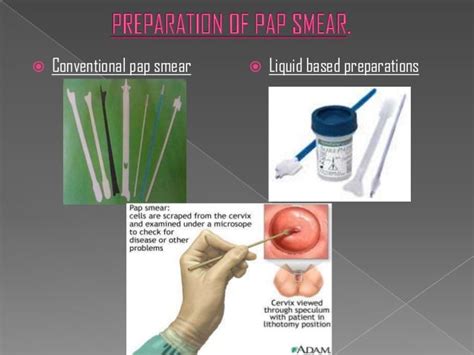 pap smear test partially obscuring thick areas are present|Endocervical and Squamous Metaplastic Cells on a Pap Smear.